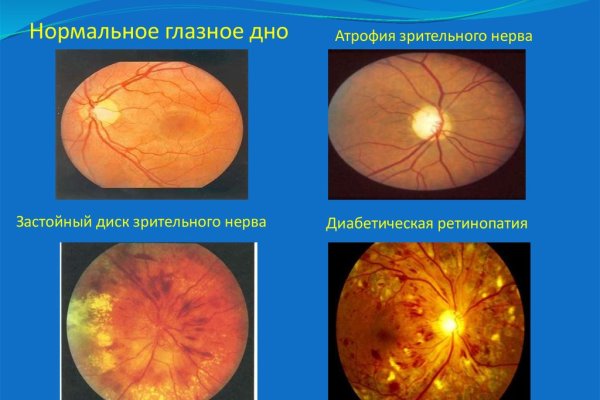 Восстановить аккаунт на кракене